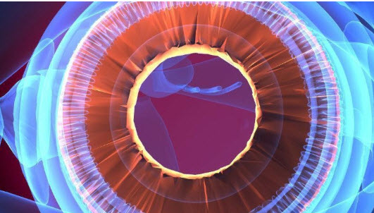 cataract surgery needed in singapore