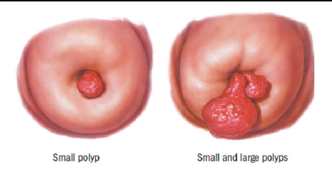 singapore gynaecologist