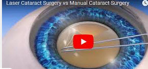 lasik surgeon singapore