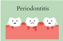 Periodontal Singapore